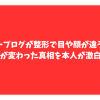 ジョーブログ　整形　顔変わった